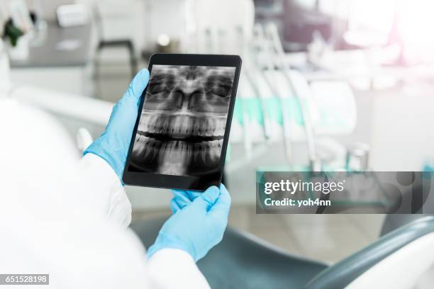 menselijke tanden x-ray op de tablet pc - tandheelkundige fotografie stockfoto's en -beelden