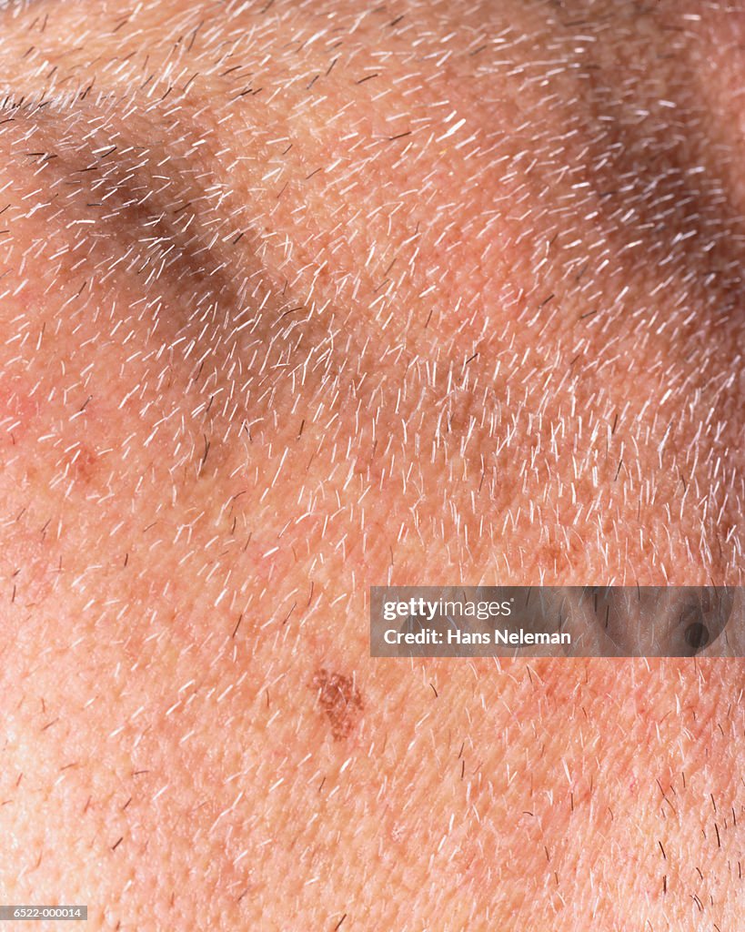 Skin with Stubble