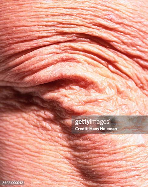 wrinkled elbow - ellenbogen stock-fotos und bilder