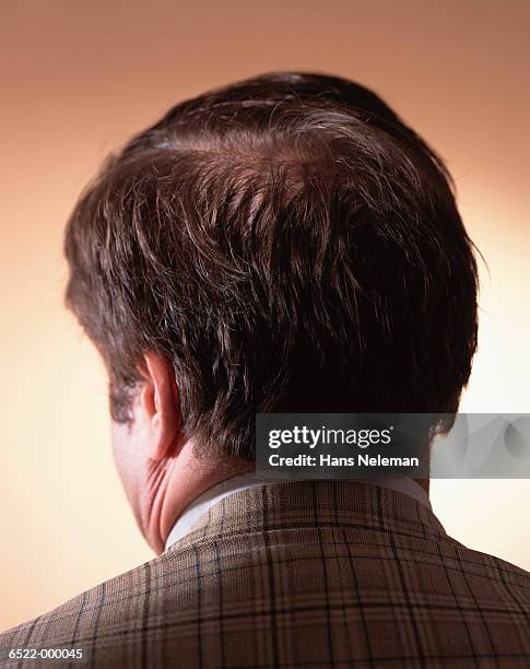 back of man's head - back of head stockfoto's en -beelden