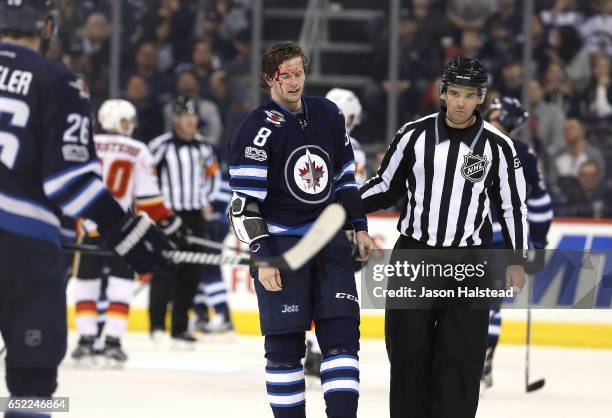 Bloodied Jacob Trouba of the Winnipeg Jets skates to his bench after fighting Sam Bennett of the Calgary Flames during NHL action on March 11, 2017...