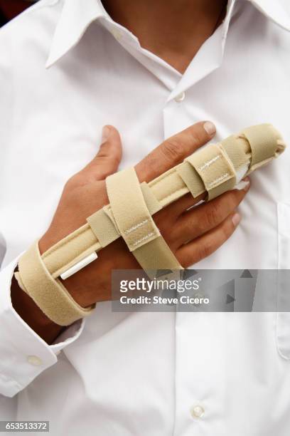 man with broken middle finger - image stockfoto's en -beelden