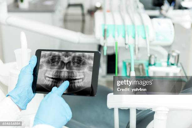 dental radiogram on tablet - dental equipment stock pictures, royalty-free photos & images