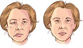 white background vector illustration of a  facial lopsided illustration