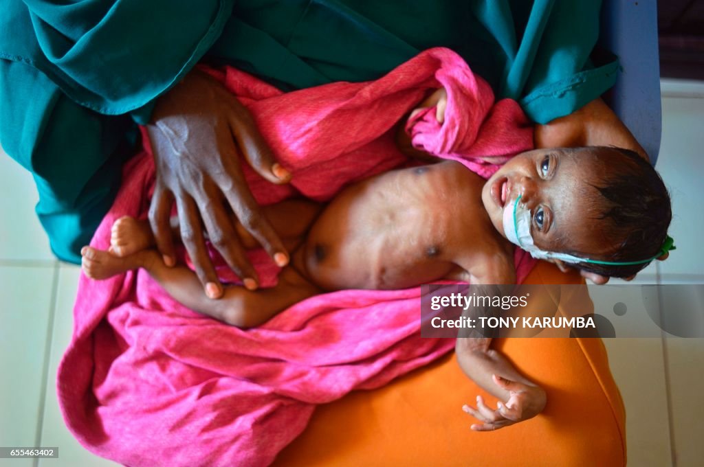TOPSHOT-SOMALIA-CONFLICT-DROUGHT-FAMINE