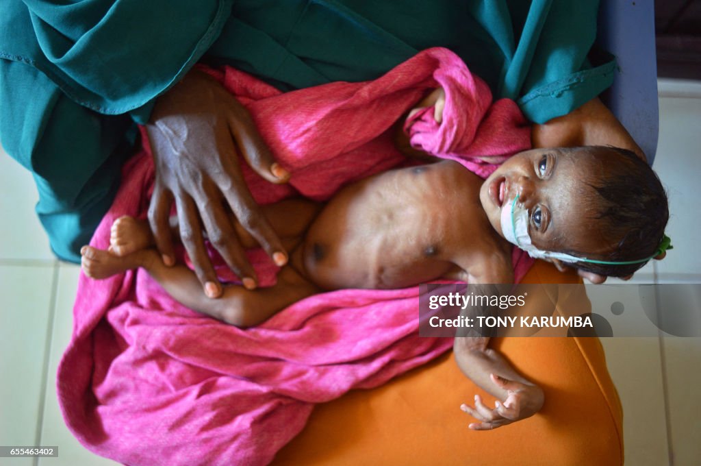 TOPSHOT-SOMALIA-CONFLICT-DROUGHT-FAMINE