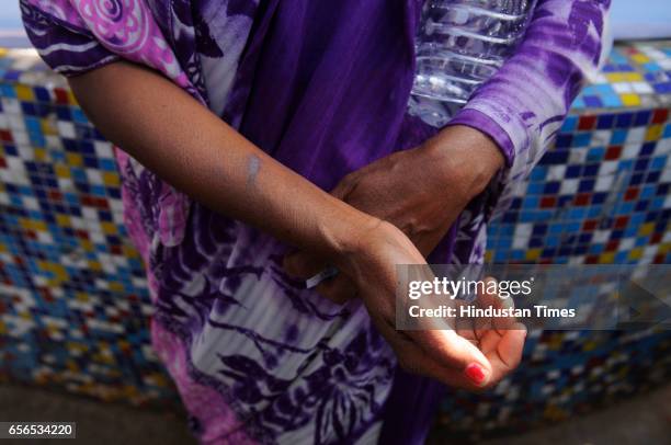 Mother of a 19-year-old acid attack victim girl at All India Institute of Medical Sciences on March 22, 2017 in New Delhi, India. Forced to drink...