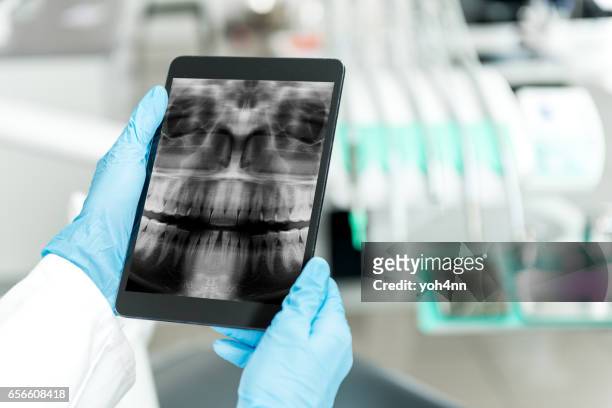 expertise von dental funkspruch auf tablet - implant stock-fotos und bilder