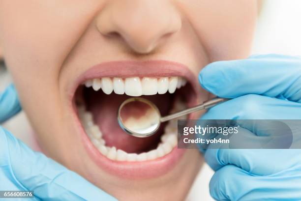 zahnärztliche untersuchung und hygiene - zähne stock-fotos und bilder