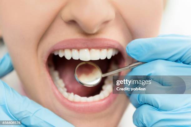 dental exam and hygiene - implante imagens e fotografias de stock