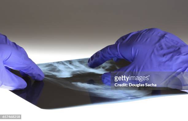 dental surgeon examines x-ray image prior to surgery - デンタルダム ストックフォトと画像
