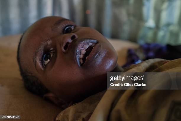 March 6, 2017: A badly malnourished child lies in a tent on the outskirts of Mogadishu. Somalia is in the grip of an intense drought, induced by...