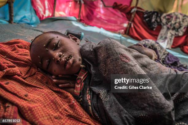 March 7, 2017: A young child covered in flies sleeps in a hot tent in a internally displaced persons camp in central Mogadishu. Somalia is in the...