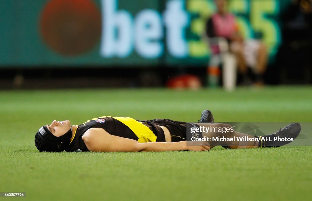 AFL Rd 2 - Richmond v Collingwood