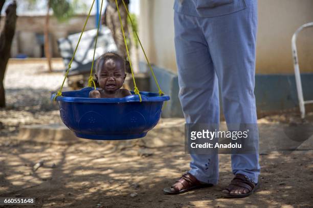 Somalian baby is seen in a bucket at Bay State Regional Hospital in Somalia on March 30, 2017. In the central and south parts of Somalia, extreme...
