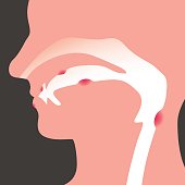 oral disease, image illustration