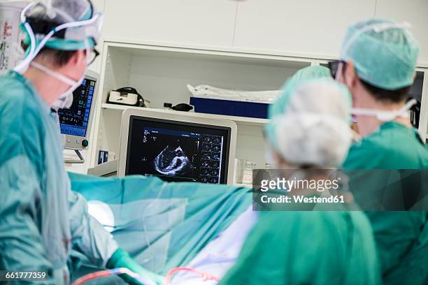 heart surgeons and operating room nurse looking at monitor - heart surgery stock pictures, royalty-free photos & images