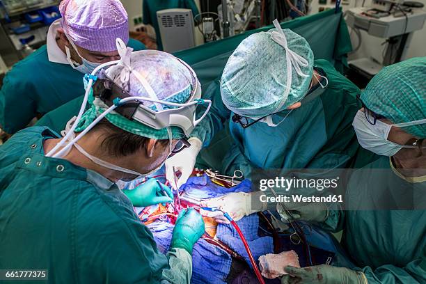 heart surgeons and operating room nurse during a heart valve operation - heart valve stock-fotos und bilder