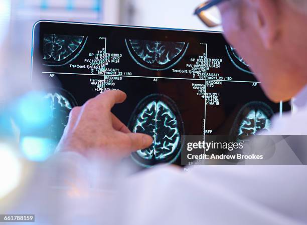 radiologist assessing ct brain scan - neurology stock pictures, royalty-free photos & images