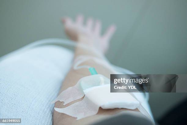 an arm with drip infusion. - iv infusion stockfoto's en -beelden