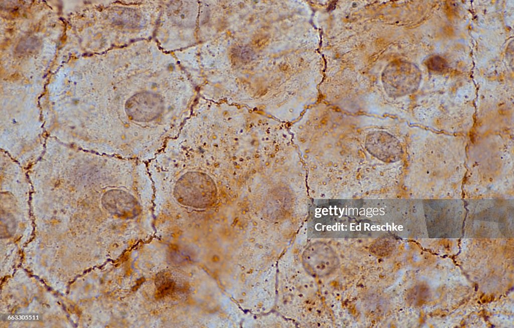 Simple Squamous Epithelium--Mesothelium