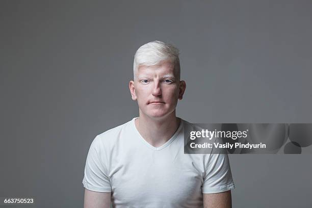 portrait of young albino man against gray background - white skin stock pictures, royalty-free photos & images