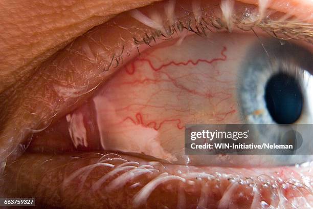 details of a human eye - veia imagens e fotografias de stock