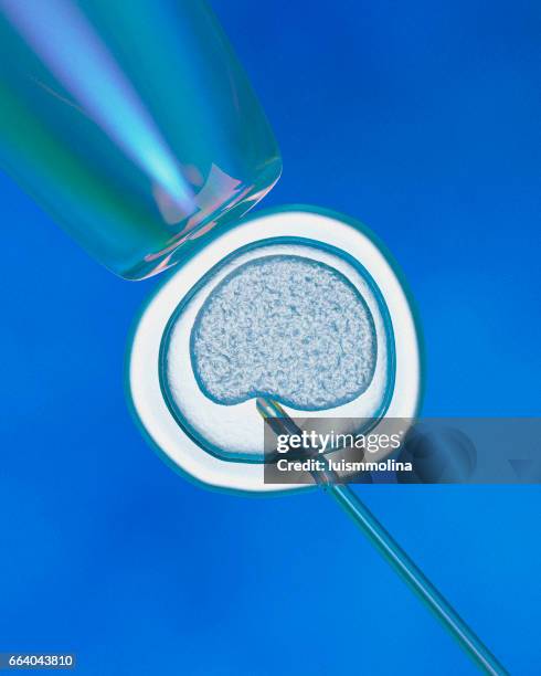 Extraction of embryonic stem cells 이미지 (664043810) - 게티이미지뱅크