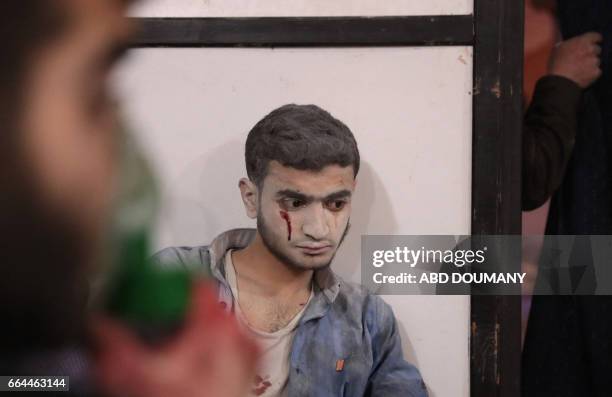 Syrian man waits to receive treatment at a makeshift clinic following reported air strikes by government forces in the rebel-held town of Douma, on...