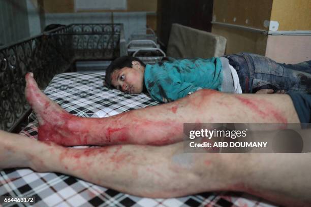 Graphic content / A Syrian boy receives treatment at a makeshift clinic following reported air strikes by government forces in the rebel-held town of...