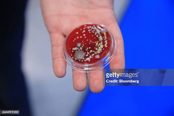 An attendee displays a petri dish of bacteria collected during a flight from California to Hamburg to demonstrate the operation of a germ killer...