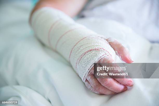 woman in the hospital, operated hand - accident hospital stock pictures, royalty-free photos & images