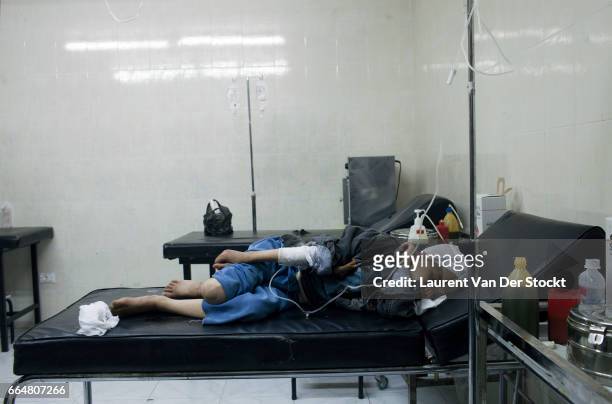 Young boy wounded by shelling of the Syrian Army at the second hospital of Kfar Batna.
