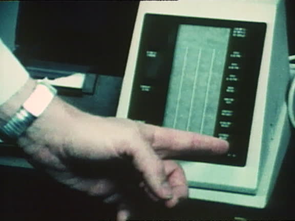 Pacemaker Monitor Videos and HD Footage - Getty Images