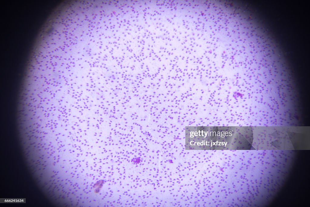 Chicken Mince Under Microscope Microscope Under Chicken Mcdonalds ...