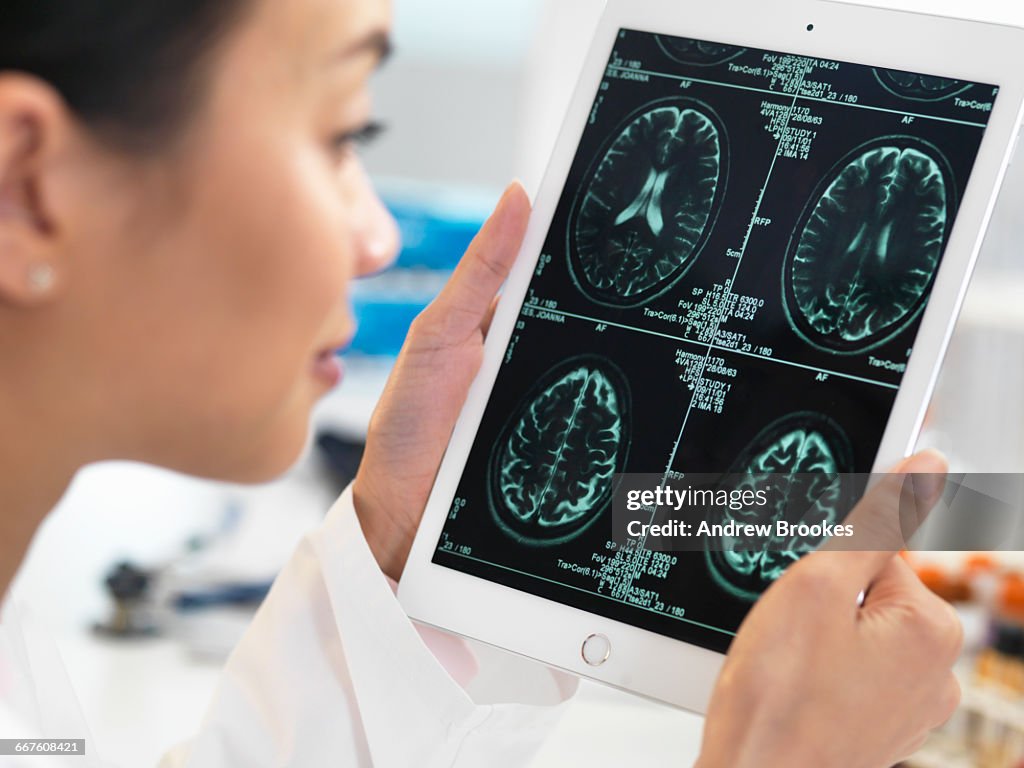 Doctor viewing CT scan result of brain on digital tablet for abnormalities