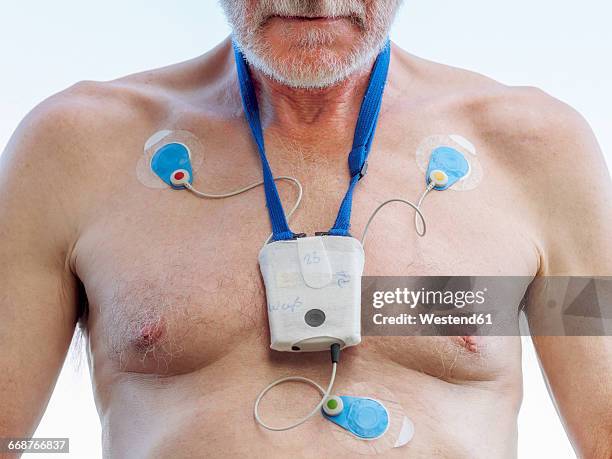 senior man with long-term ecg on his chest, close up - atrial fibrillation stock pictures, royalty-free photos & images