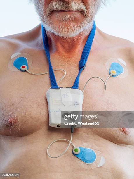 senior man with long-term ecg on his chest, close up - atrial fibrillation stock pictures, royalty-free photos & images