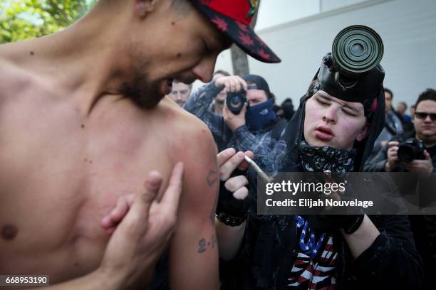 Trump supporter shows a protester a bruise from an earlier clash at a "Patriots Day" free speech rally on April 15, 2017 in Berkeley, California....