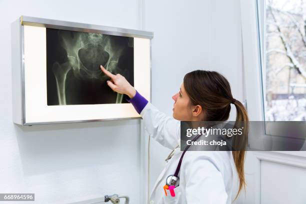 pretty young woman doctor watching x-ray image of human pelvis.... - x ray pelvis stock pictures, royalty-free photos & images