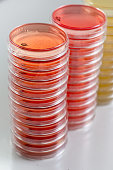 Red and yellow petri dishes stacks in microbiology lab on the bacteriology laboratory background