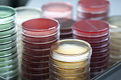 Red and yellow petri dishes stacks in microbiology lab on the bacteriology laboratory background