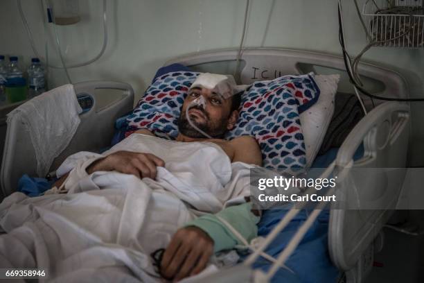 Mohammed Mahmoud, who received serious head injuries from shrapnel during an airstrike in Mosul, lies in his bed on April 17, 2017 in Erbil Emergency...