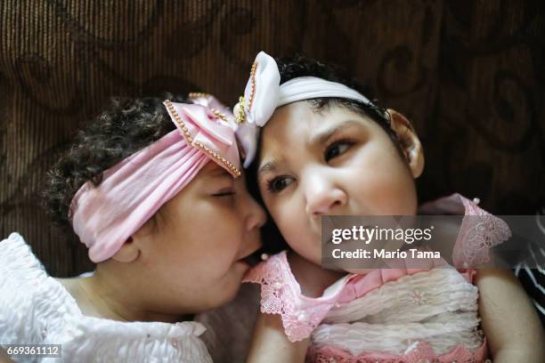 Twins Heloisa and Heloa Barbosa, both born with microcephaly, sit at their one-year birthday party on April 16, 2017 in Areia, Paraiba state, Brazil....