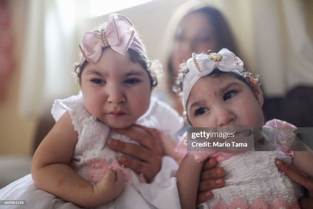 Brazilian Twins Born With Zika Celebrate Their First Birthday