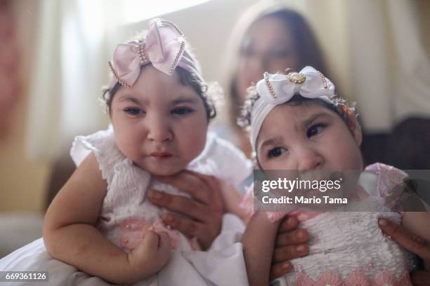 Twins Heloisa and Heloa Barbosa, both born with microcephaly, are held at their one-year birthday party on April 16, 2017 in Areia, Paraiba state,...