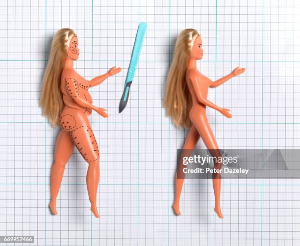 before and after plastic surgery - liposuction stock pictures, royalty-free photos & images