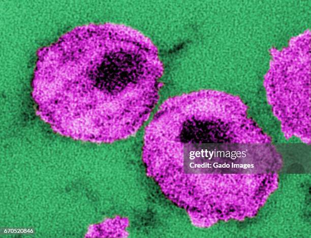 hiv virus particles - tem stock pictures, royalty-free photos & images