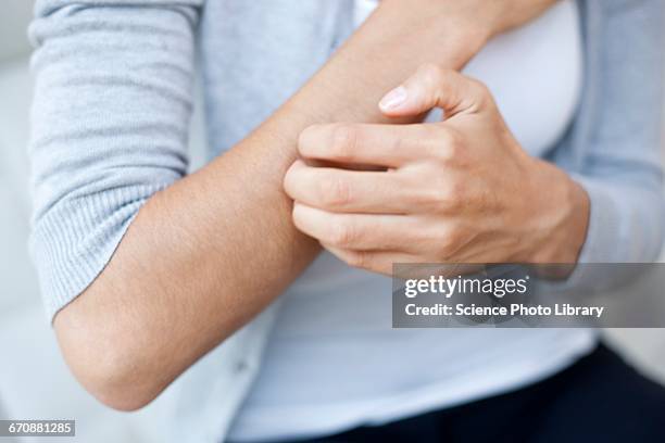 woman scratching her arm - river bildbanksfoton och bilder