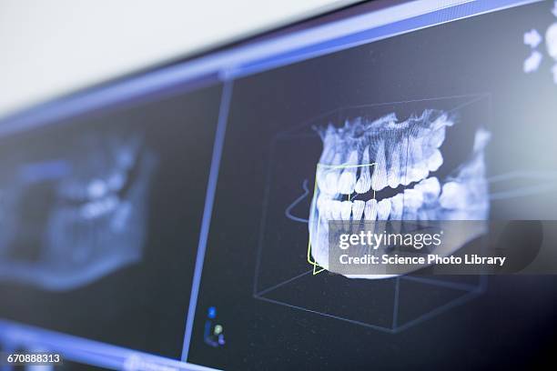 teeth x-ray - dental hygiene stock pictures, royalty-free photos & images